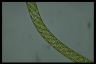 Spirogyra