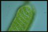 Spirogyra