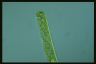 Spirogyra