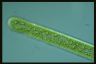 Spirogyra