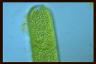 Spirogyra