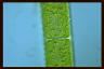 Spirogyra