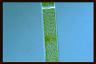 Spirogyra