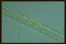 Spirogyra