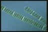 Spirogyra