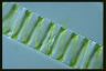 Spirogyra