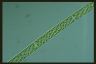 Spirogyra