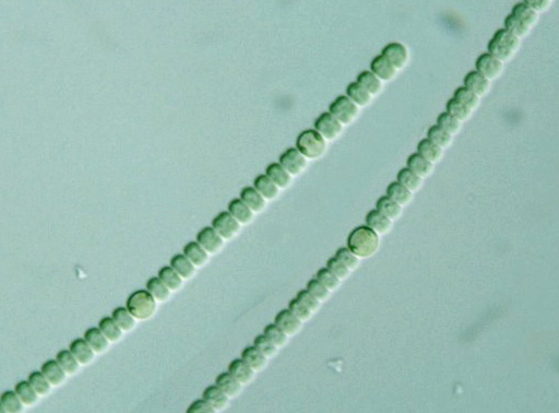 Anabaena Akinete