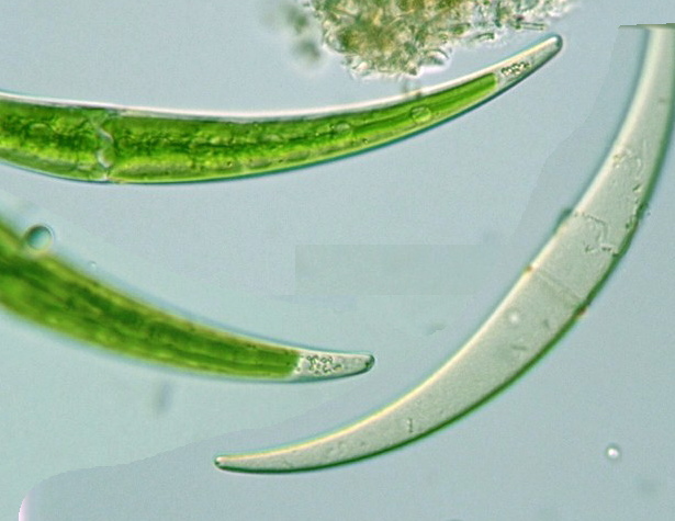 Closterium dianae