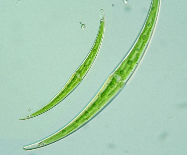 Closterium dianae