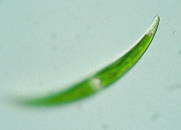 Closterium dianae
