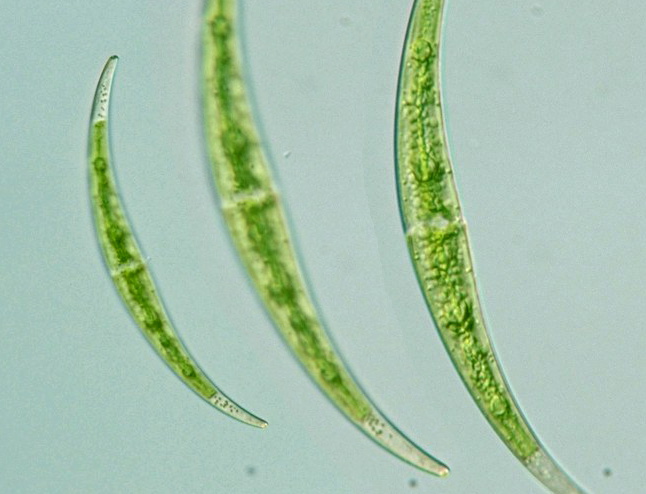 Closterium dianae