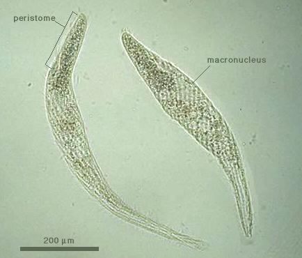 Spirostomum filum