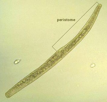 Spirostomum intermedium