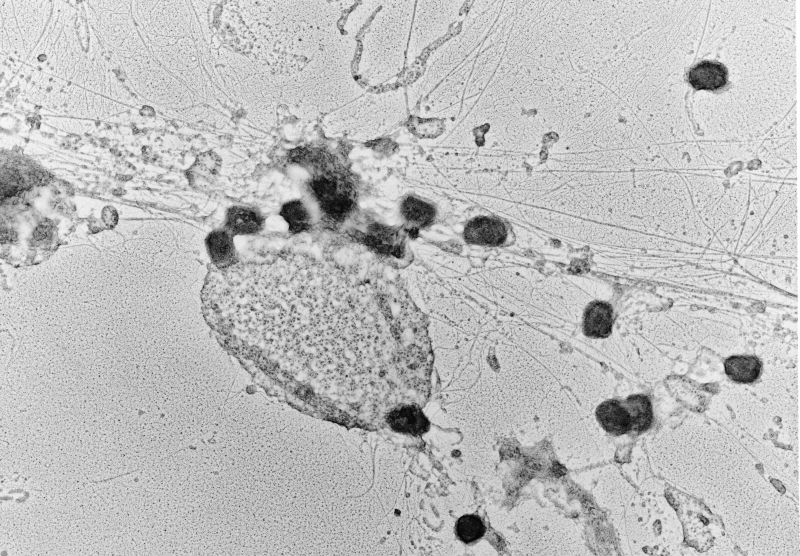 VacciniaV-4